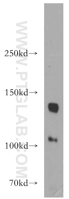 Western Blot (WB) analysis of A431 cells using TGFBR3-Specific Polyclonal antibody (20000-1-AP)