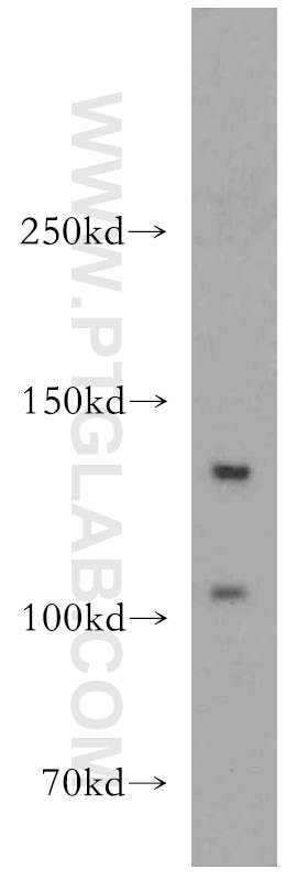 Western Blot (WB) analysis of A549 cells using TGFBR3-Specific Polyclonal antibody (20000-1-AP)