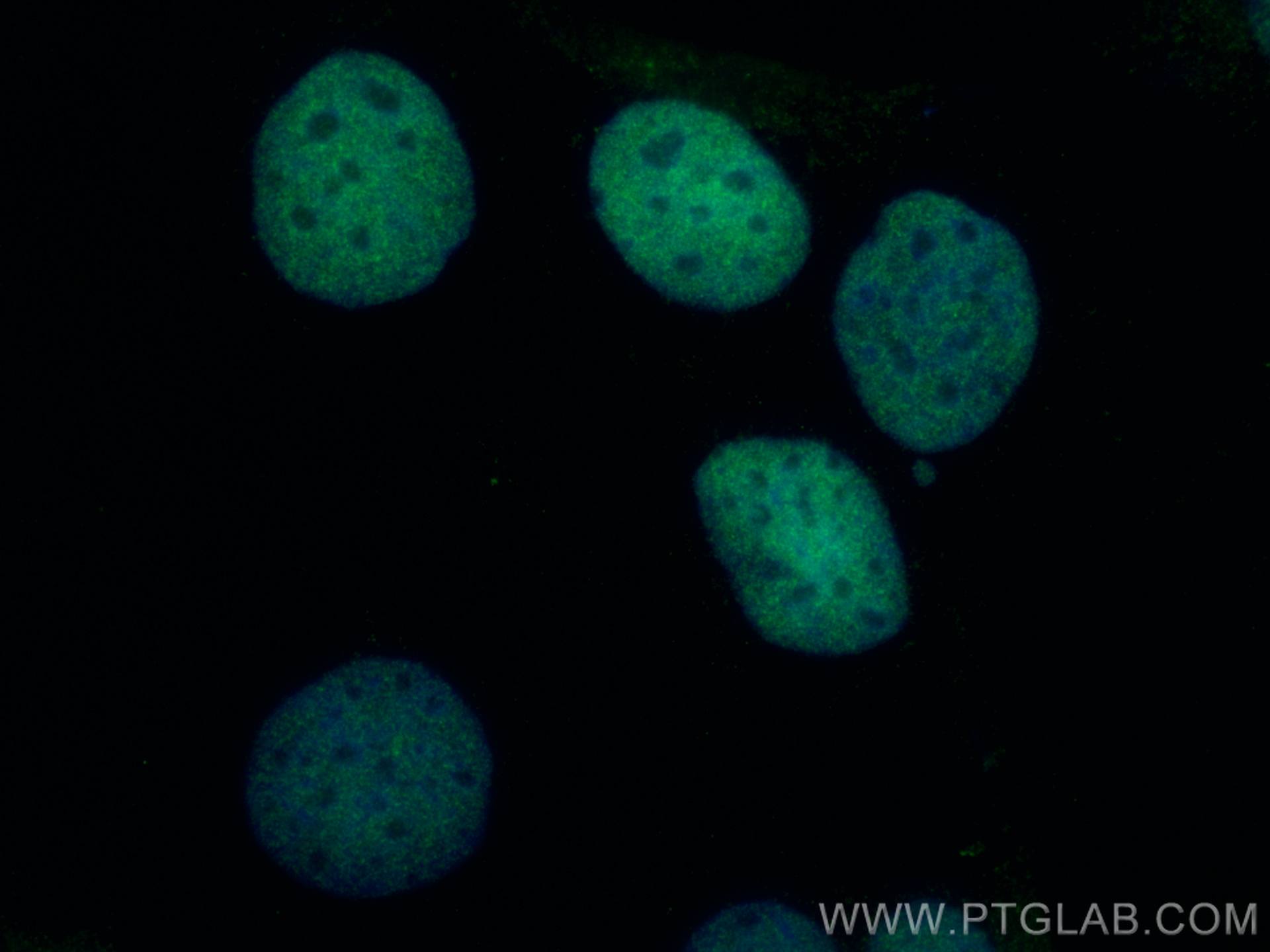 Immunofluorescence (IF) / fluorescent staining of Caco-2 cells using TGIF2 Polyclonal antibody (11522-1-AP)