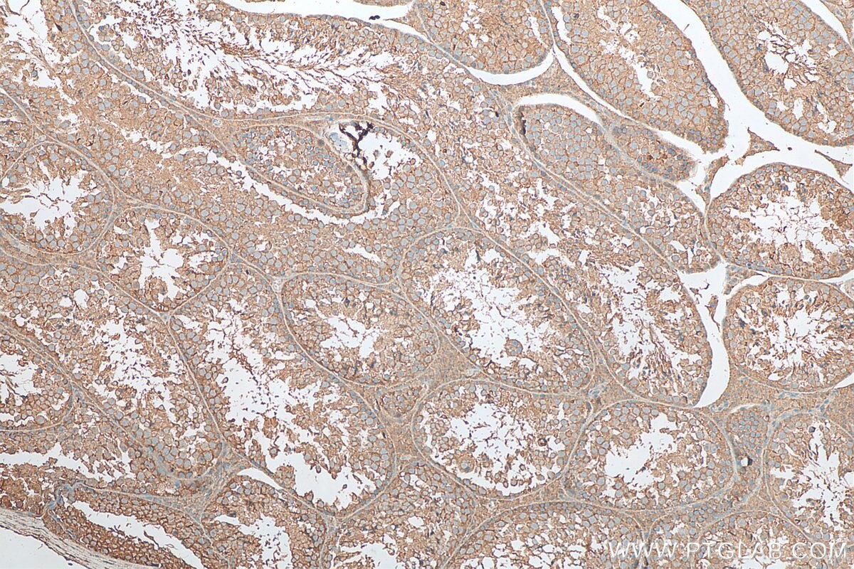 Immunohistochemistry (IHC) staining of mouse testis tissue using TGIF2 Polyclonal antibody (11522-1-AP)