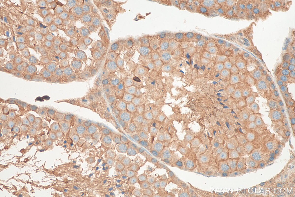 Immunohistochemistry (IHC) staining of mouse testis tissue using TGIF2 Polyclonal antibody (11522-1-AP)