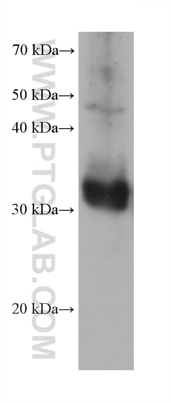 Western Blot (WB) analysis of COLO 320 cells using TGIF2 Monoclonal antibody (67576-1-Ig)