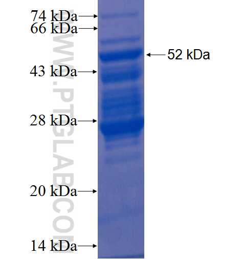 TGIF2 fusion protein Ag2085 SDS-PAGE