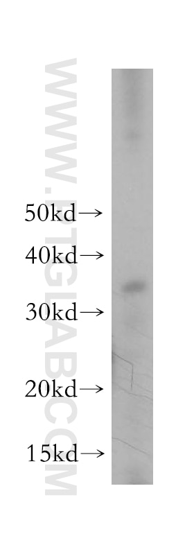 Western Blot (WB) analysis of human testis tissue using TGIF2LX Polyclonal antibody (17405-1-AP)