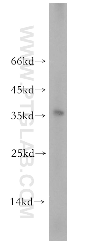 Western Blot (WB) analysis of human testis tissue using TGIF2LX Polyclonal antibody (17405-1-AP)