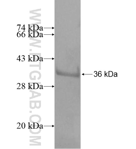 TGIF2LX fusion protein Ag11408 SDS-PAGE