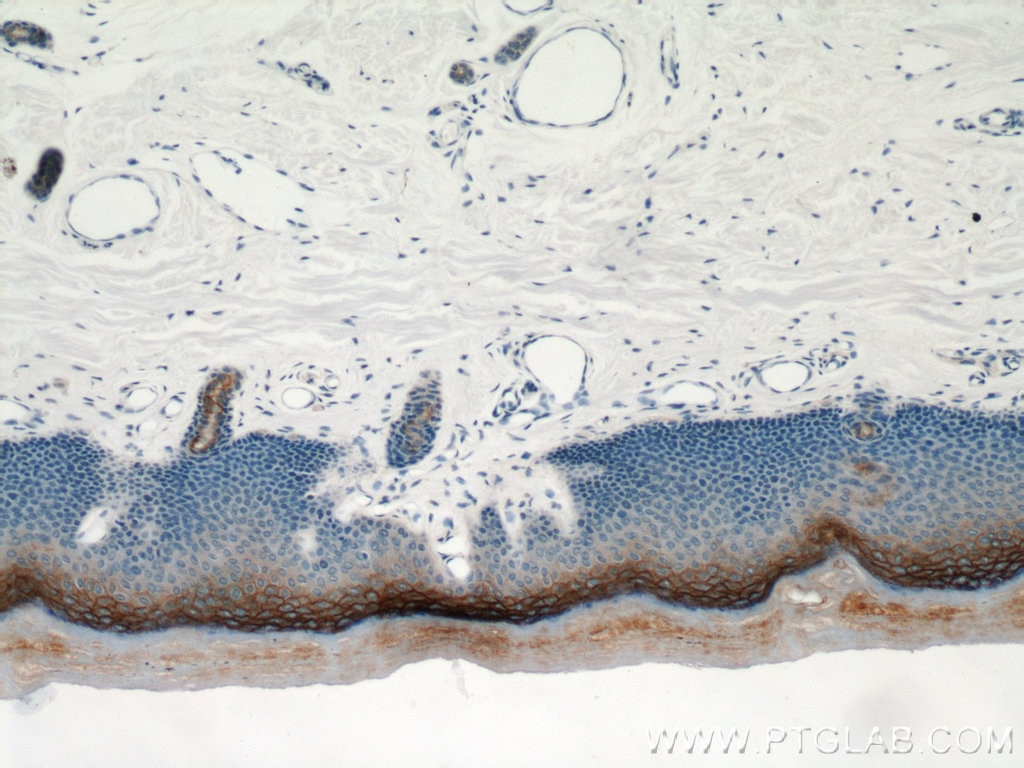 Immunohistochemistry (IHC) staining of human skin tissue using TGM1 Polyclonal antibody (12912-3-AP)