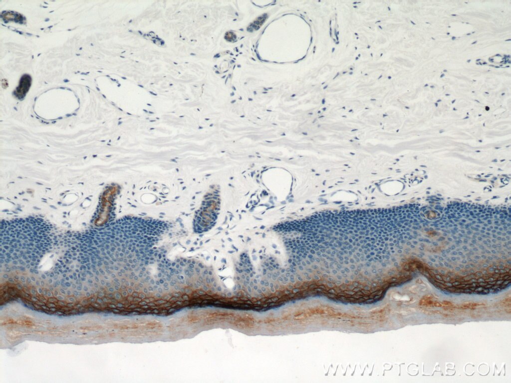 IHC staining of human skin using 12912-3-AP