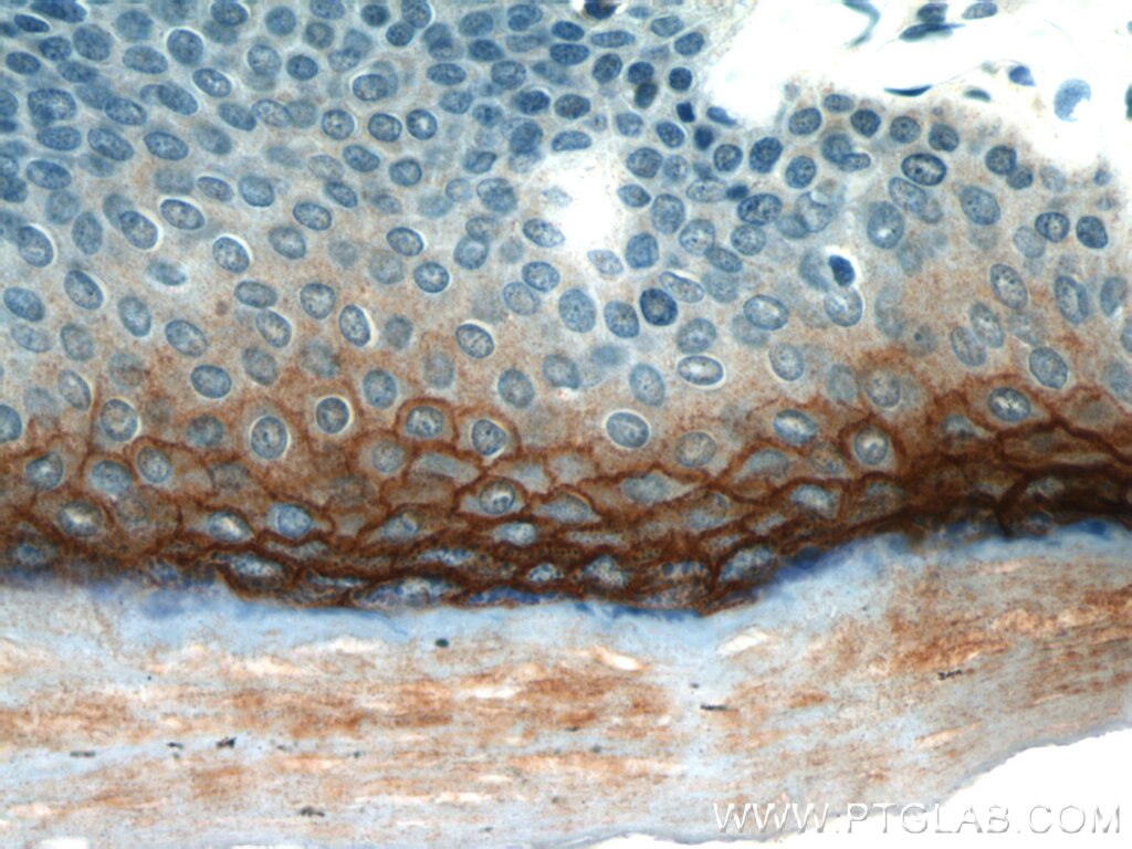 Immunohistochemistry (IHC) staining of human skin tissue using TGM1 Polyclonal antibody (12912-3-AP)