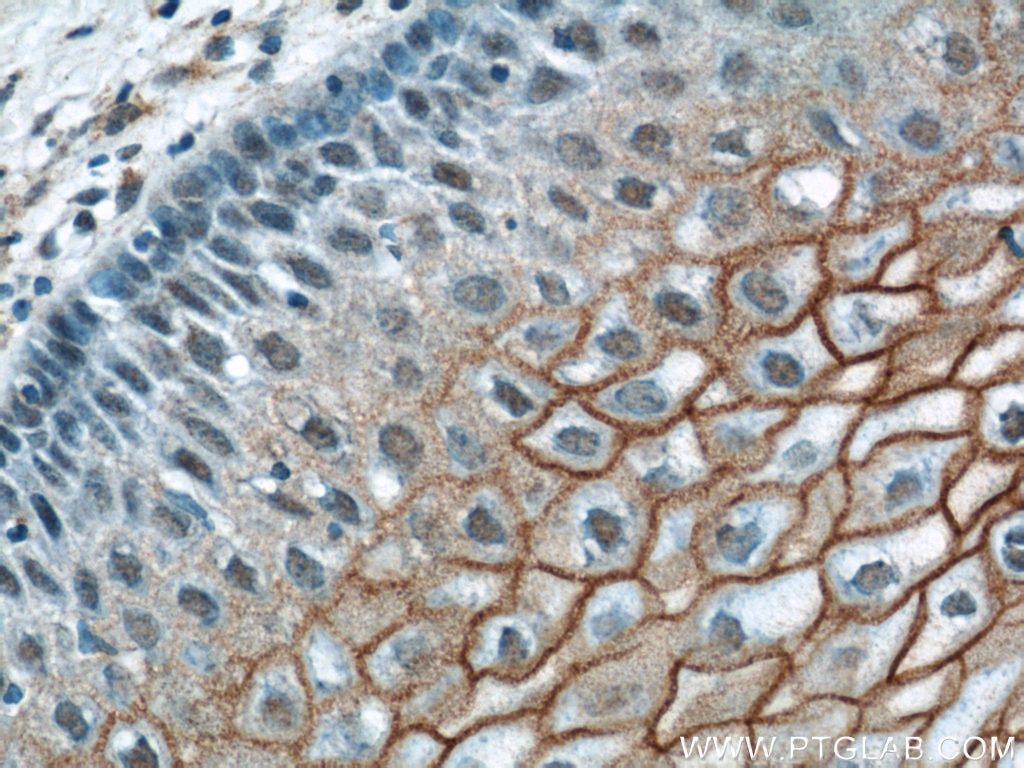 Immunohistochemistry (IHC) staining of human cervix tissue using TGM1 Polyclonal antibody (12912-3-AP)