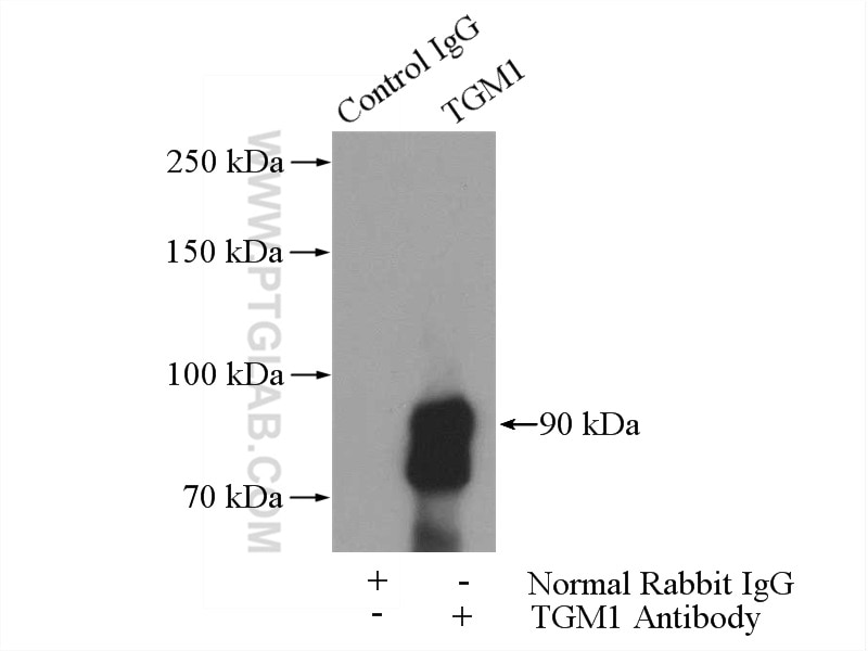 Immunoprecipitation (IP) experiment of mouse kidney tissue using TGM1 Polyclonal antibody (12912-3-AP)
