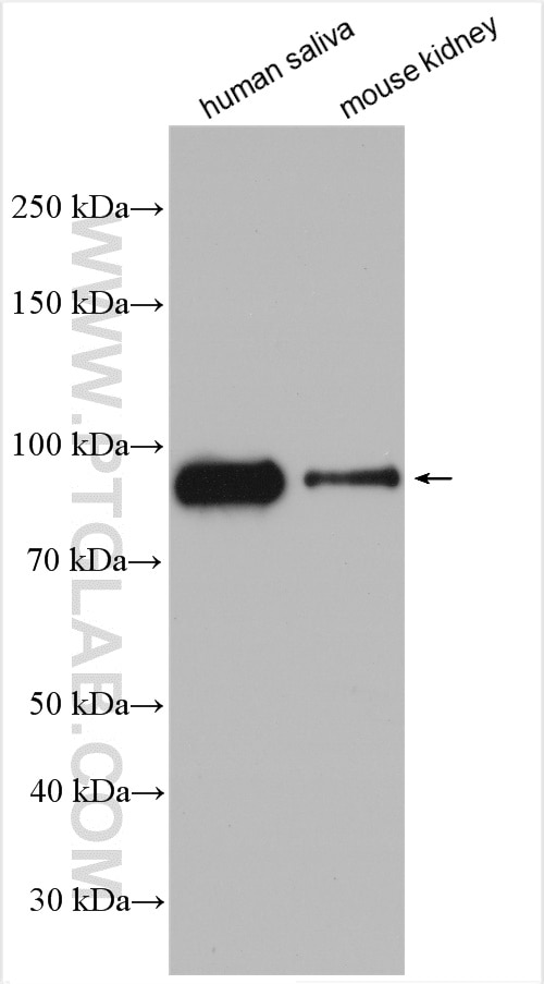 Western Blot (WB) analysis of various lysates using TGM1 Polyclonal antibody (12912-3-AP)