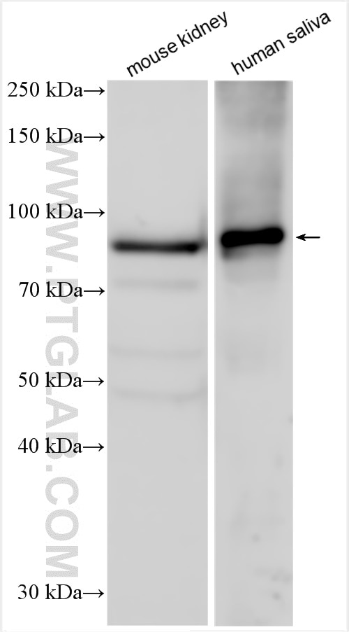 Western Blot (WB) analysis of various lysates using TGM1 Polyclonal antibody (12912-3-AP)
