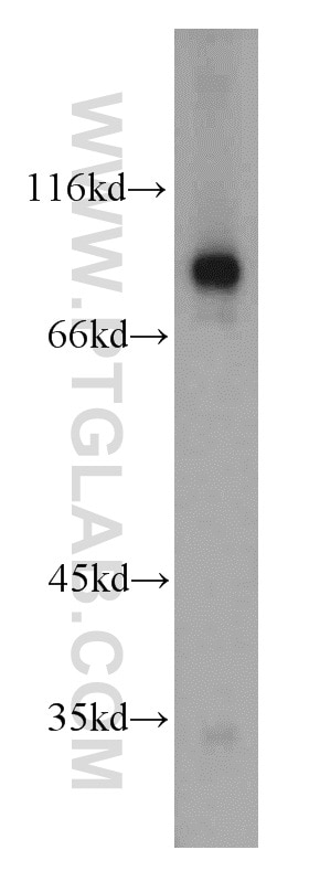 Western Blot (WB) analysis of mouse kidney tissue using TGM1 Polyclonal antibody (12912-3-AP)