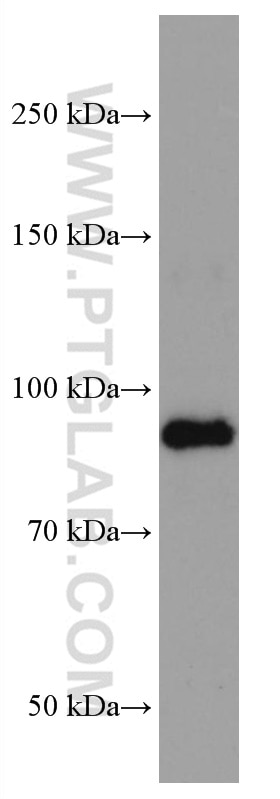 Western Blot (WB) analysis of human saliva using TGM1 Monoclonal antibody (67004-1-Ig)