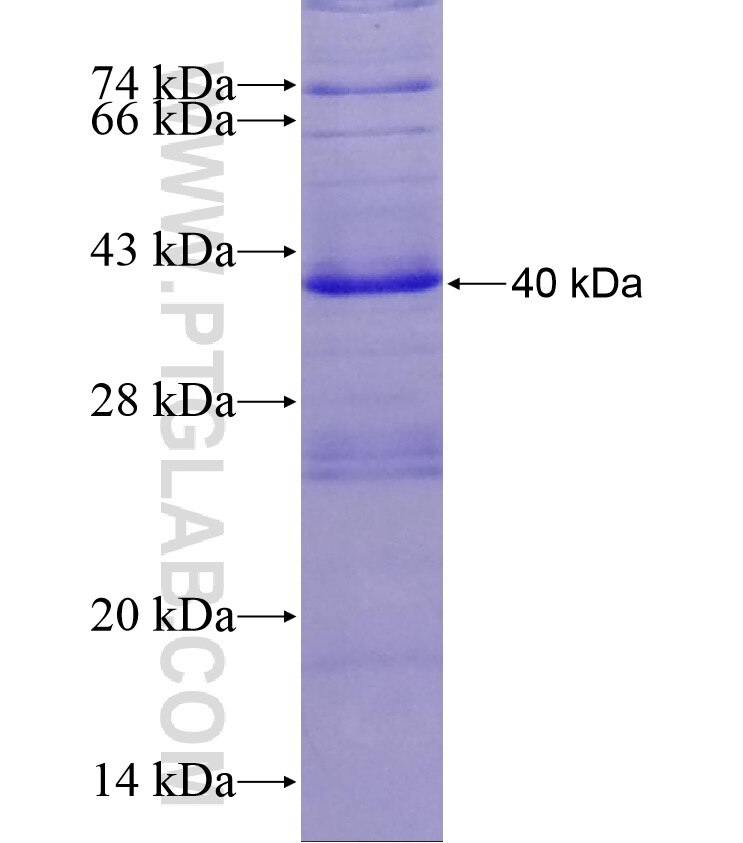 TGM1 fusion protein Ag17969 SDS-PAGE