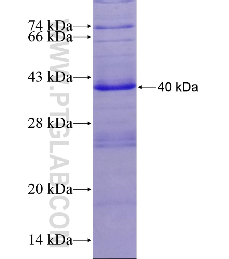 TGM1 fusion protein Ag17969 SDS-PAGE