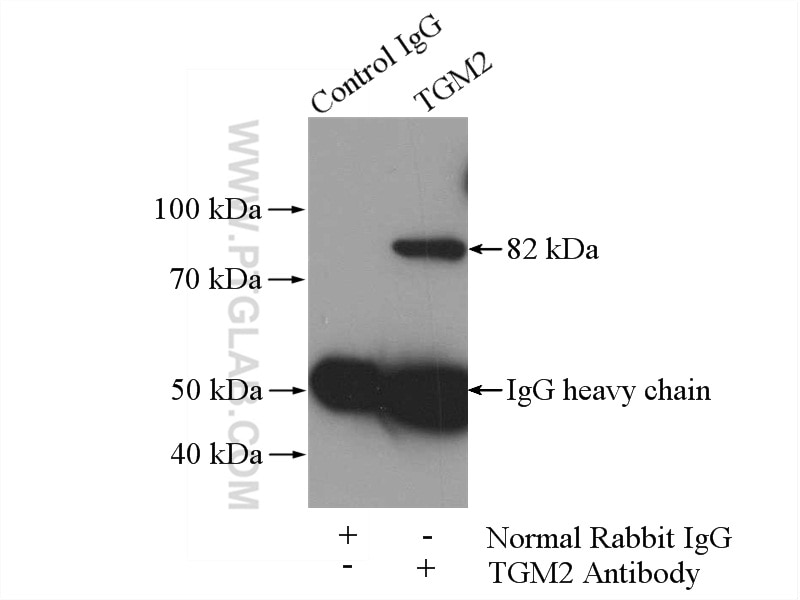 Immunoprecipitation (IP) experiment of HeLa cells using TGM2 Polyclonal antibody (15100-1-AP)