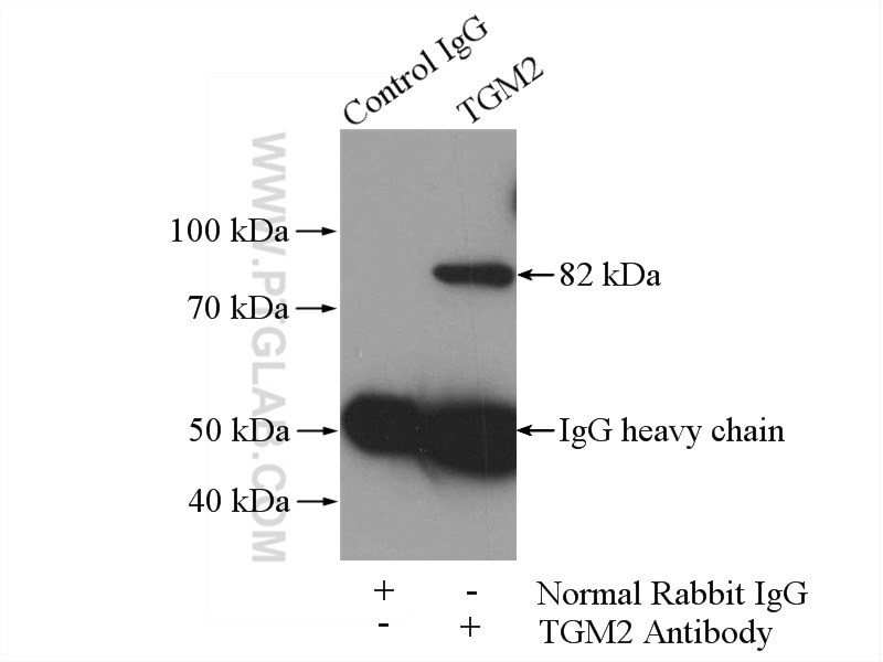 IP experiment of HeLa using 15100-1-AP