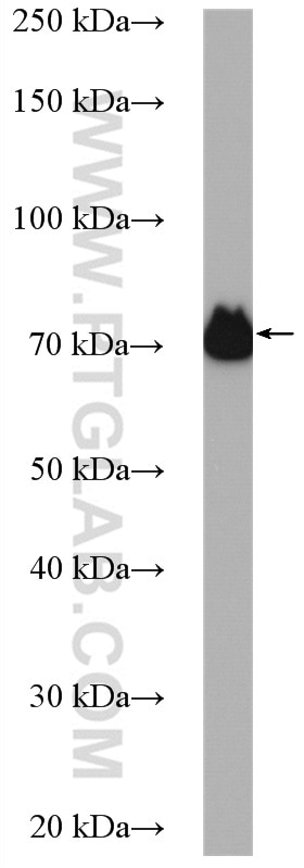 Western Blot (WB) analysis of HUVEC cells using TGM2 Polyclonal antibody (15100-1-AP)