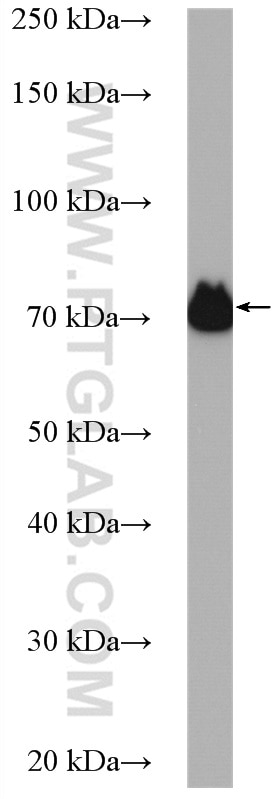 WB analysis of HUVEC using 15100-1-AP