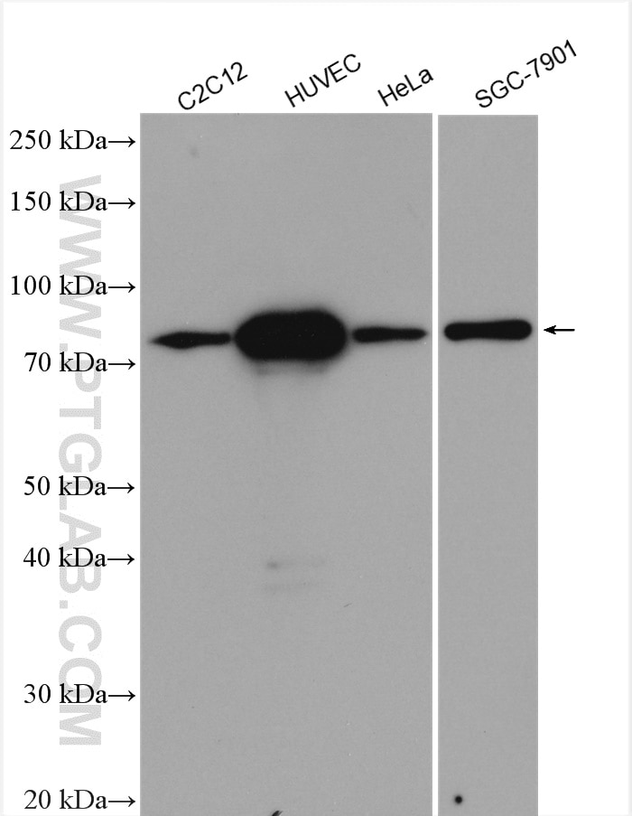 Western Blot (WB) analysis of various lysates using TGM2 Polyclonal antibody (15100-1-AP)