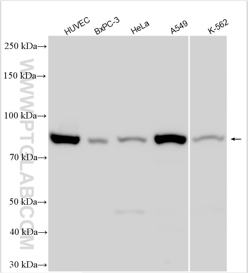 Western Blot (WB) analysis of various lysates using TGM2 Polyclonal antibody (15100-1-AP)