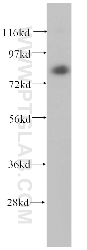 TGM2 Polyclonal antibody