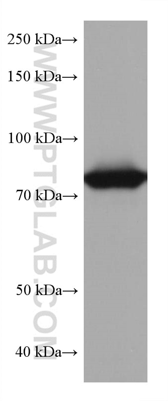 Western Blot (WB) analysis of human placenta tissue using TGM2 Monoclonal antibody (68006-1-Ig)