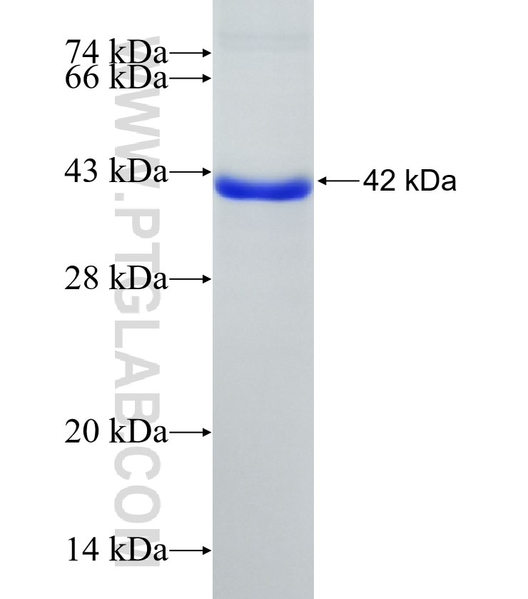 TGM2 fusion protein Ag7462 SDS-PAGE
