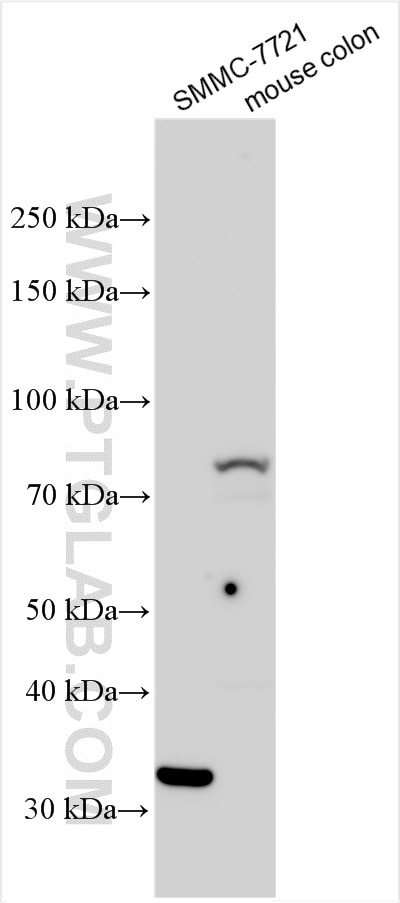 Western Blot (WB) analysis of various lysates using TGM3 Polyclonal antibody (21406-1-AP)