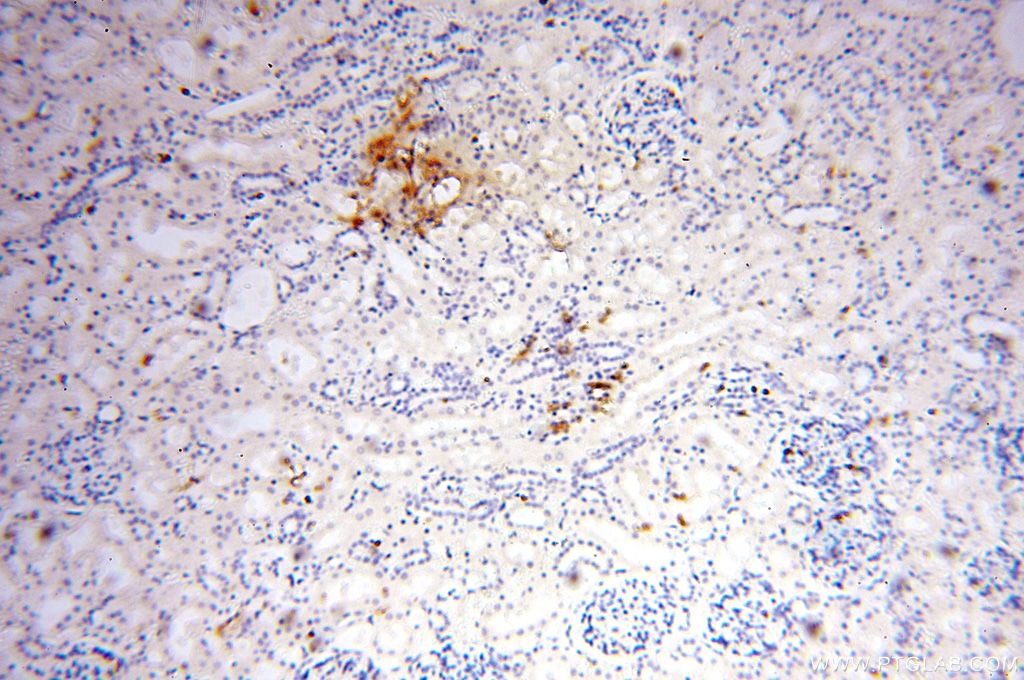 Immunohistochemistry (IHC) staining of human kidney tissue using TGM4 Polyclonal antibody (15847-1-AP)