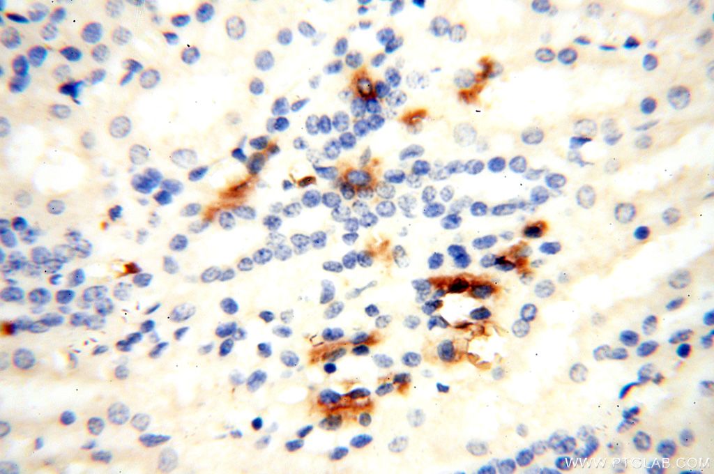 Immunohistochemistry (IHC) staining of human kidney tissue using TGM4 Polyclonal antibody (15847-1-AP)