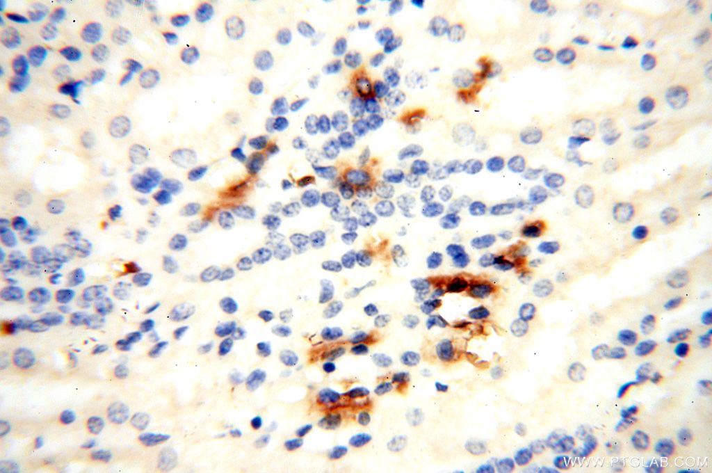 IHC staining of human kidney using 15847-1-AP