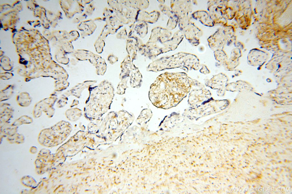 IHC staining of human placenta using 15847-1-AP