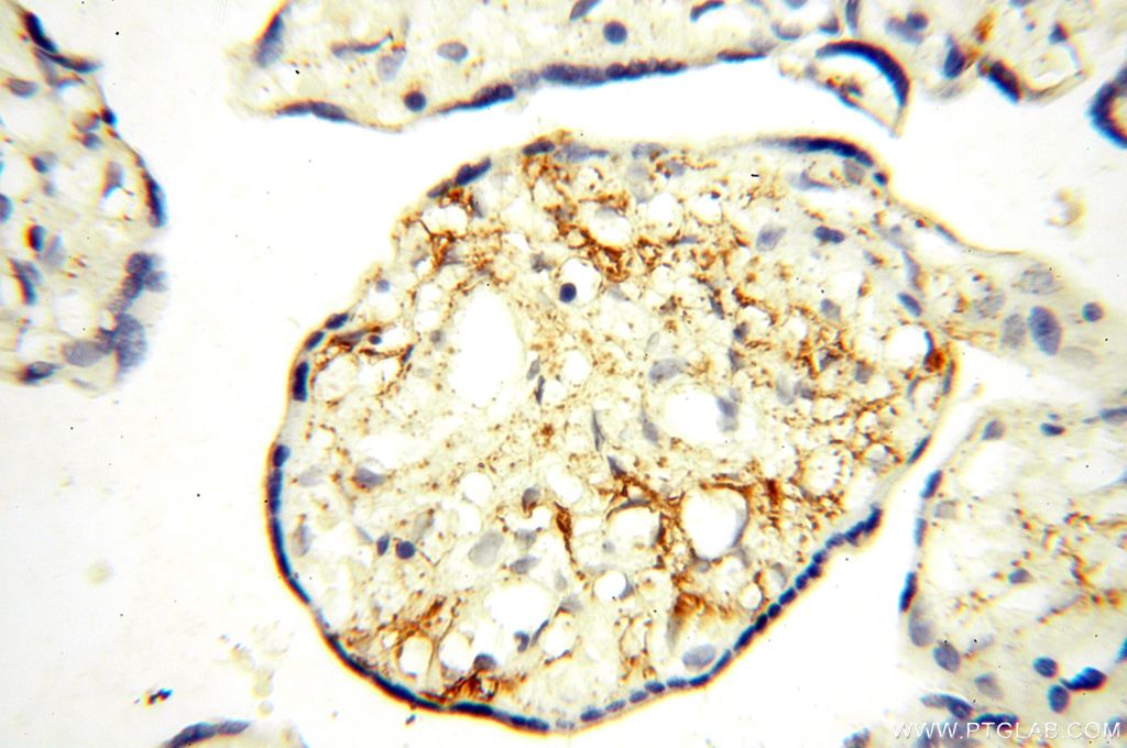 Immunohistochemistry (IHC) staining of human placenta tissue using TGM4 Polyclonal antibody (15847-1-AP)