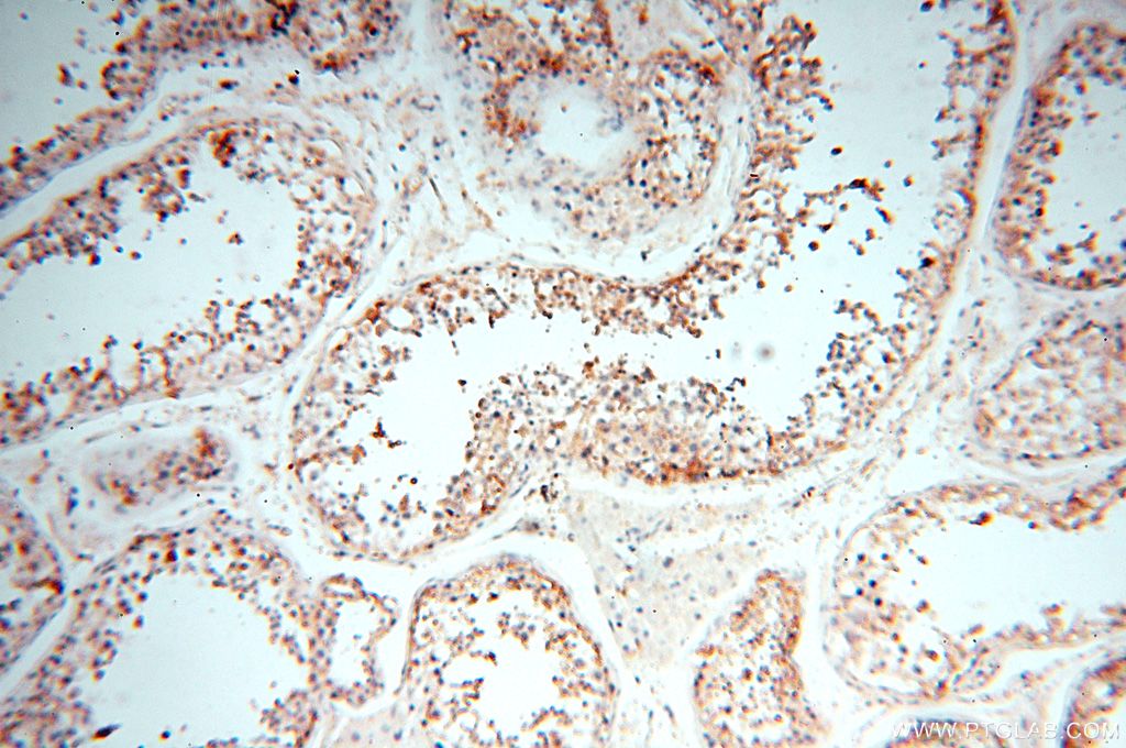IHC staining of human testis using 15847-1-AP