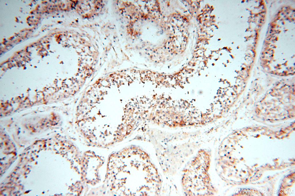 Immunohistochemistry (IHC) staining of human testis tissue using TGM4 Polyclonal antibody (15847-1-AP)