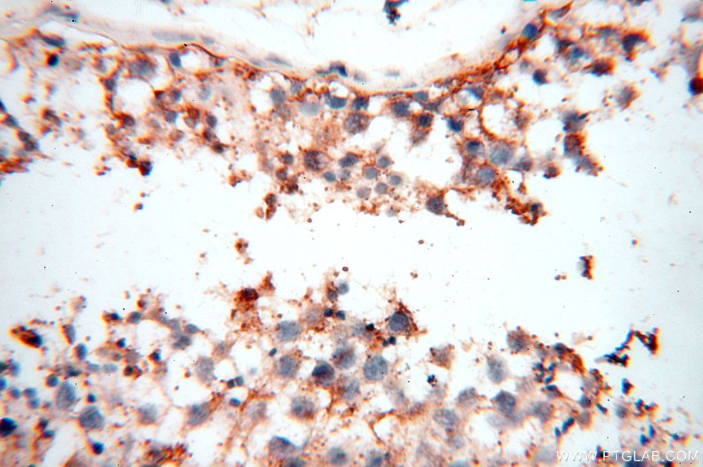 Immunohistochemistry (IHC) staining of human testis tissue using TGM4 Polyclonal antibody (15847-1-AP)