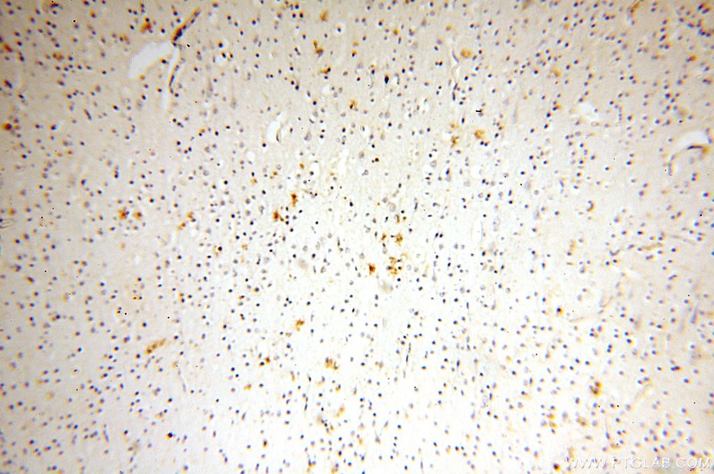 Immunohistochemistry (IHC) staining of human brain tissue using TGM4 Polyclonal antibody (15847-1-AP)