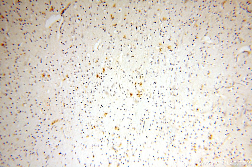 IHC staining of human brain using 15847-1-AP