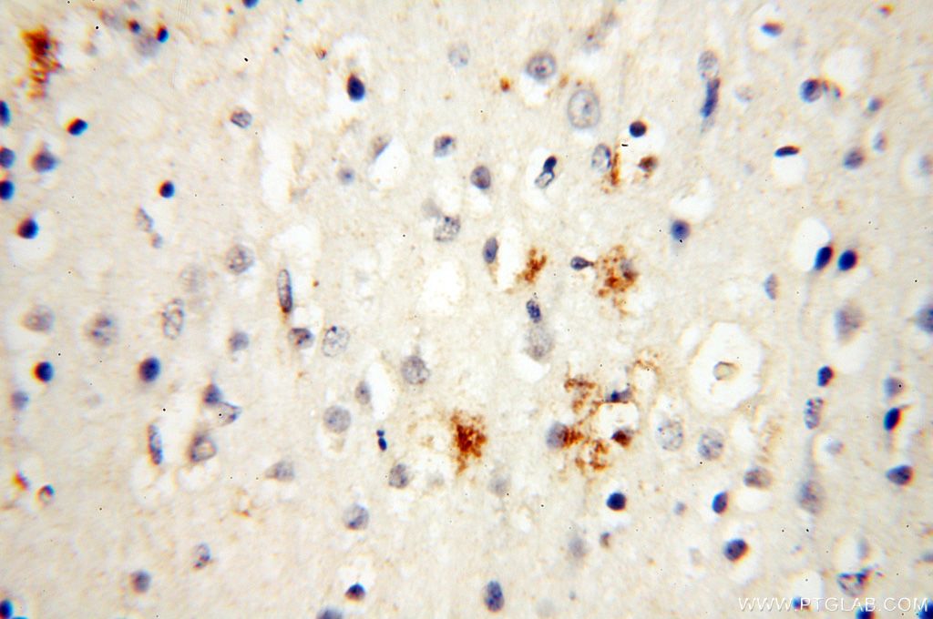 Immunohistochemistry (IHC) staining of human brain tissue using TGM4 Polyclonal antibody (15847-1-AP)