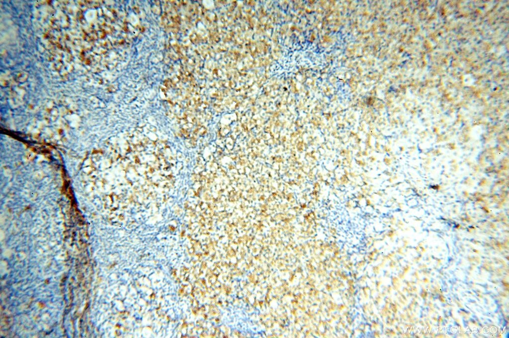 Immunohistochemistry (IHC) staining of human ovary tissue using TGM4 Polyclonal antibody (15847-1-AP)