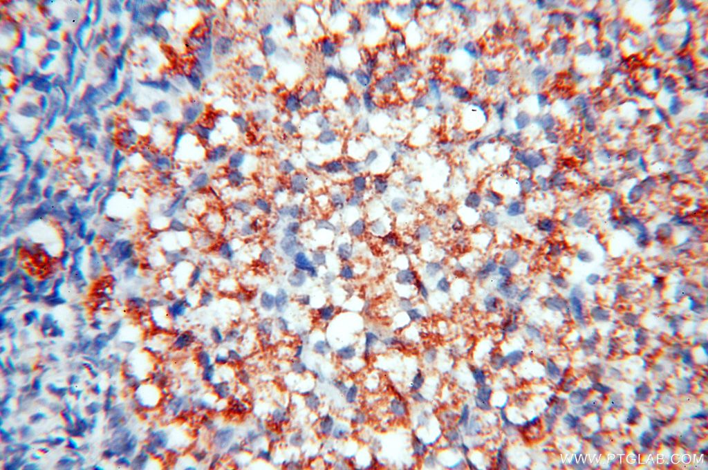 Immunohistochemistry (IHC) staining of human ovary tissue using TGM4 Polyclonal antibody (15847-1-AP)