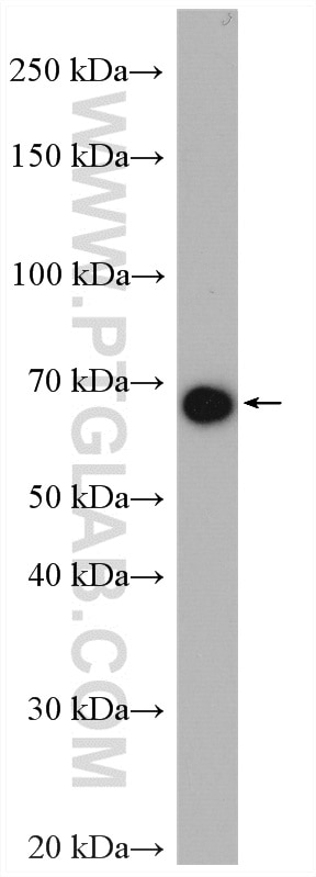 Western Blot (WB) analysis of mouse testis tissue using TGM4 Polyclonal antibody (15847-1-AP)