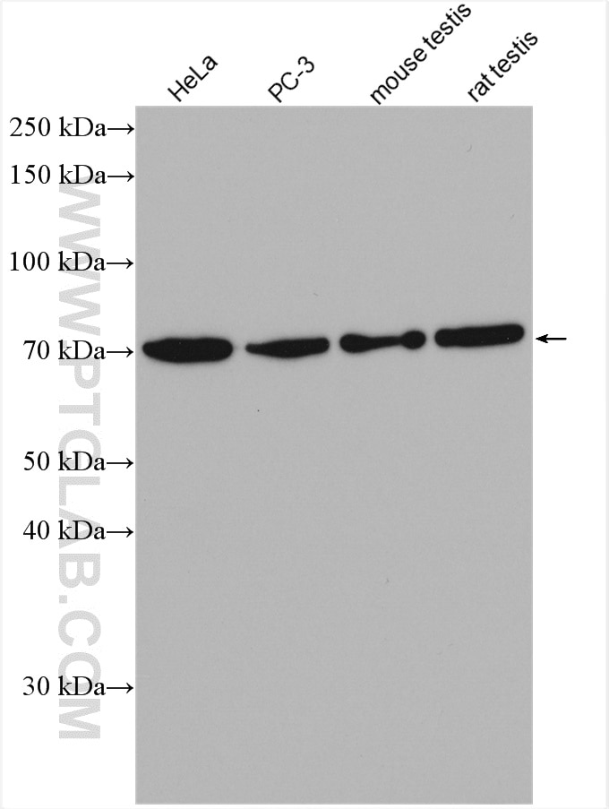 Western Blot (WB) analysis of various lysates using TGM4 Polyclonal antibody (15847-1-AP)