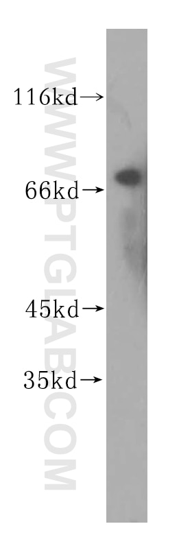 Western Blot (WB) analysis of human testis tissue using TGM4 Polyclonal antibody (15847-1-AP)
