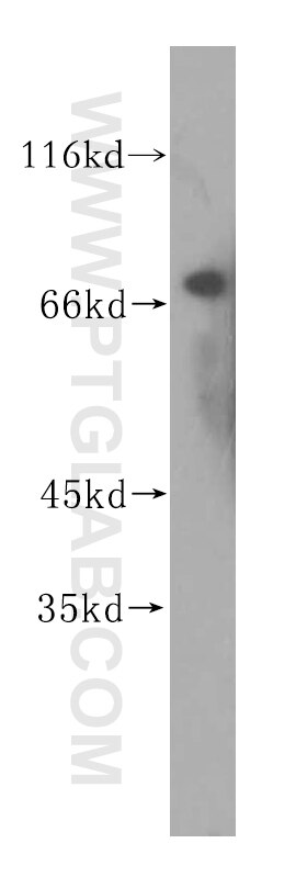 WB analysis of human testis using 15847-1-AP