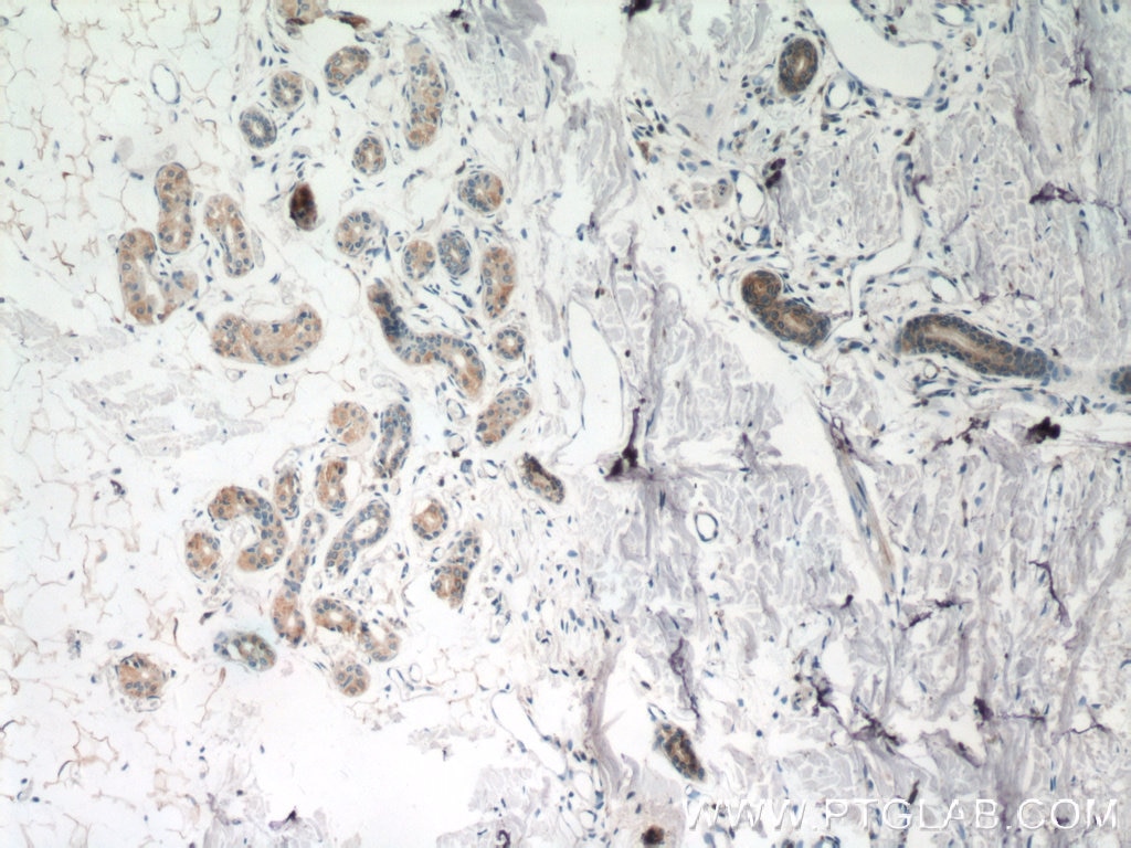 Immunohistochemistry (IHC) staining of human skin tissue using TGM5 Polyclonal antibody (25071-1-AP)