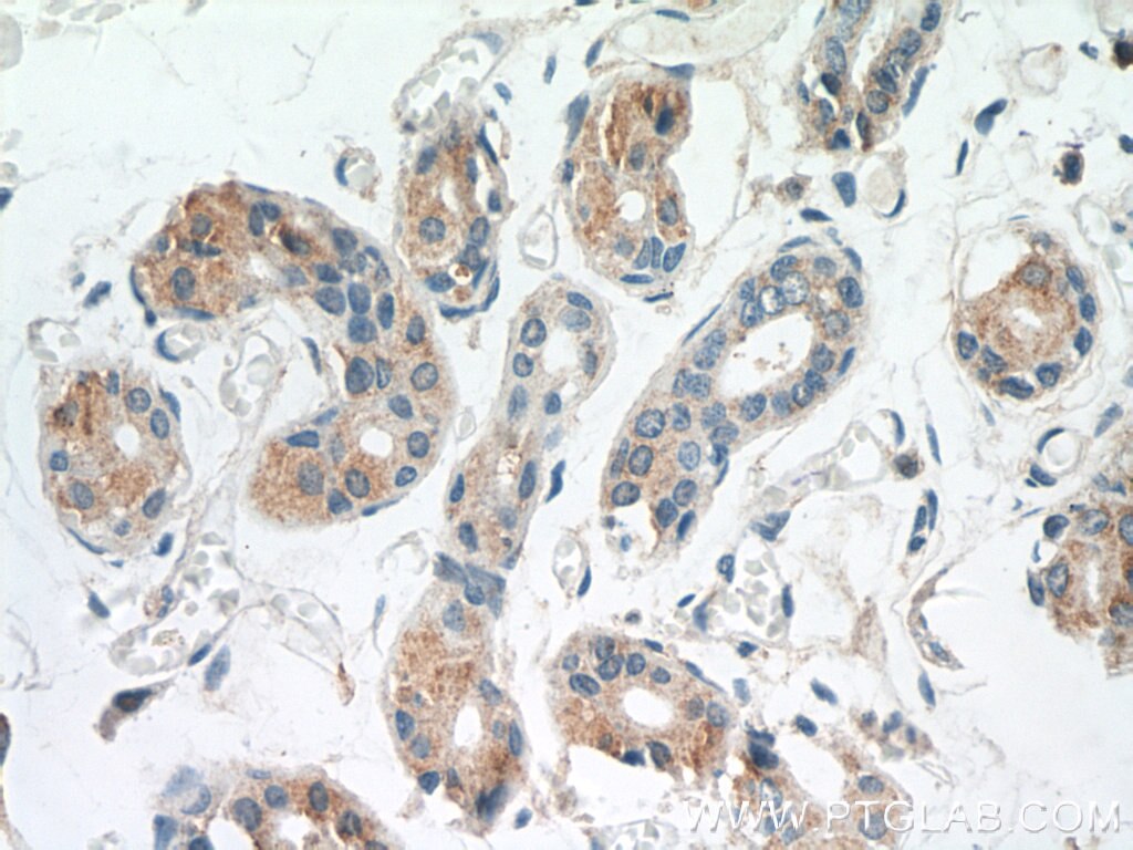 Immunohistochemistry (IHC) staining of human skin tissue using TGM5 Polyclonal antibody (25071-1-AP)